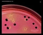Salmonella and E.coli colonies on XLD